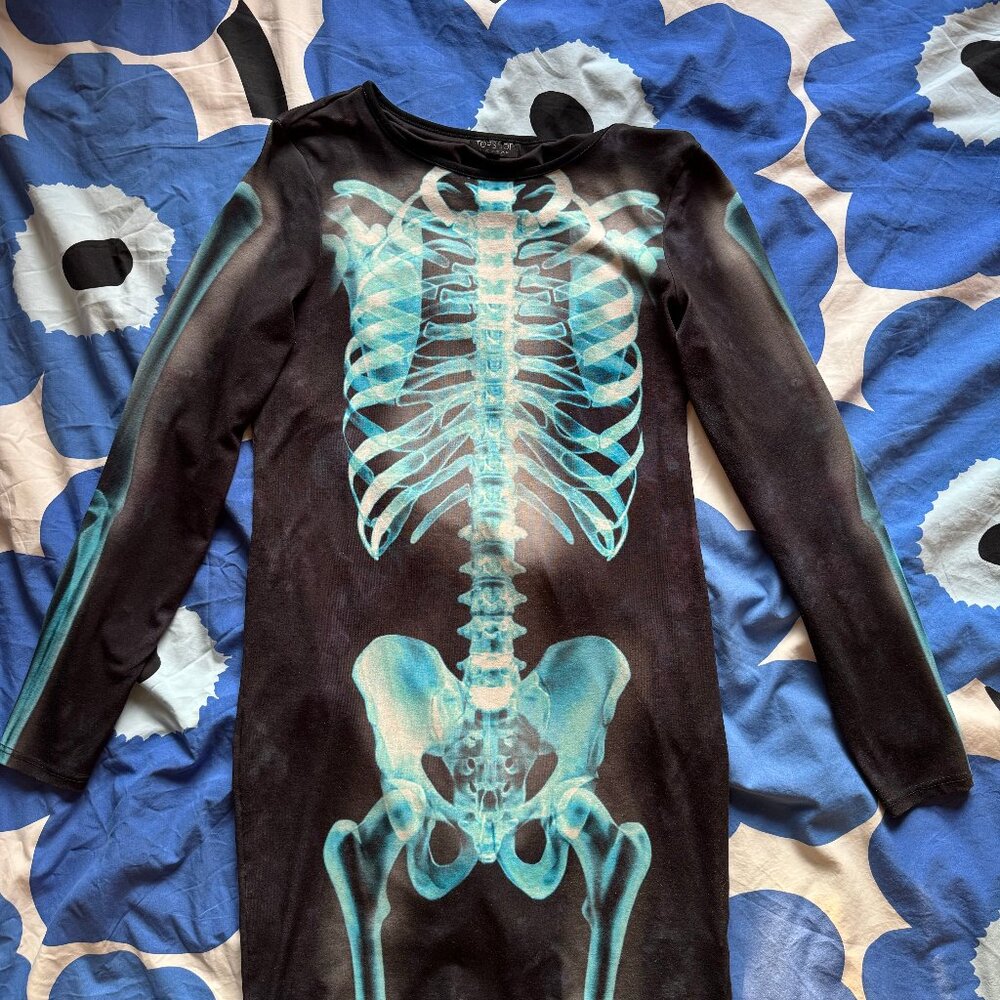 Skeleton Dress
